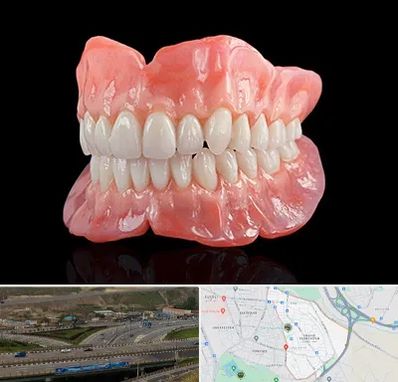 ساخت دندان مصنوعی در یاغچیان تبریز