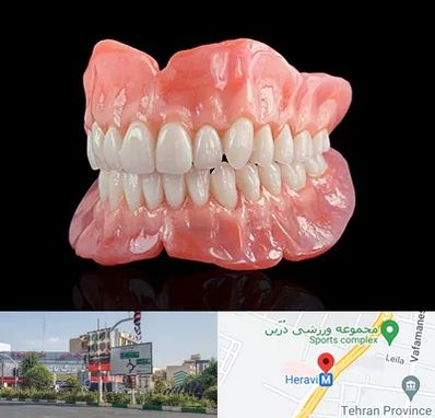ساخت دندان مصنوعی در هروی 