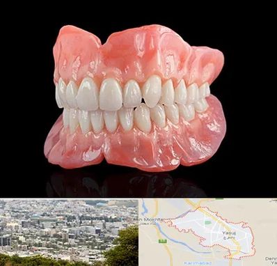 ساخت دندان مصنوعی در یاسوج