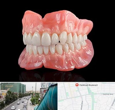 ساخت دندان مصنوعی در بلوار فرحزادی