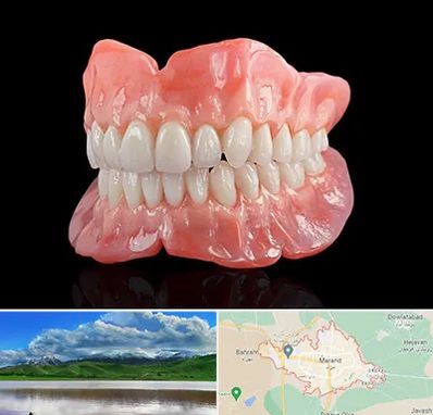 ساخت دندان مصنوعی در مرند