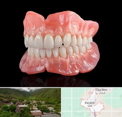 ساخت دندان مصنوعی در کلاله