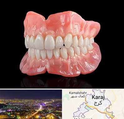 ساخت دندان مصنوعی در کرج