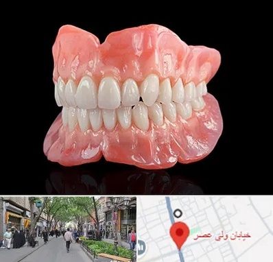 ساخت دندان مصنوعی در ولیعصر شهریار