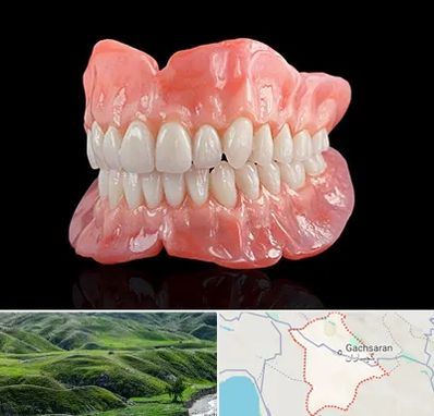 ساخت دندان مصنوعی در گچساران