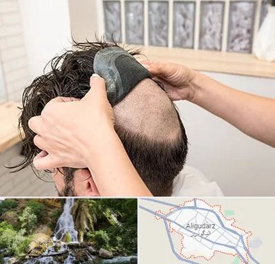 پروتز مو در الیگودرز