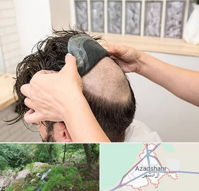 پروتز مو در آزادشهر