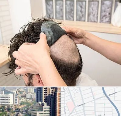 پروتز مو در خیابان بهشتی