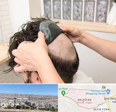 پروتز مو در شهرک گلستان شیراز 