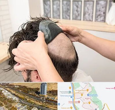 پروتز مو در خیابان نیایش شیراز 