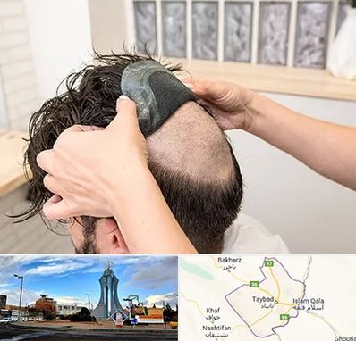 پروتز مو در تایباد