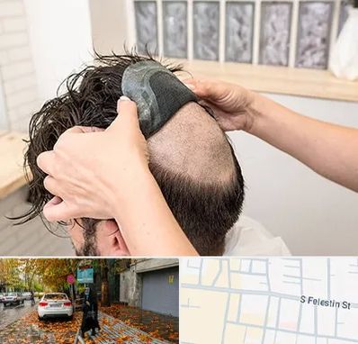 پروتز مو در خیابان فلسطین