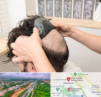 پروتز مو در قصرالدشت شیراز 