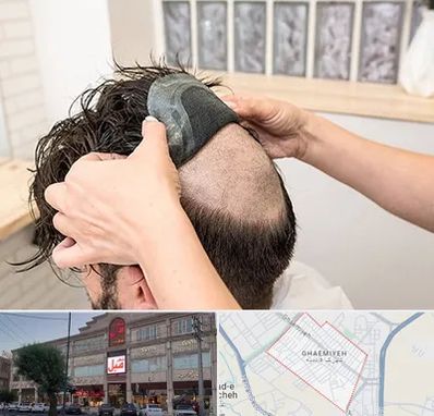 پروتز مو در قائمیه اسلامشهر