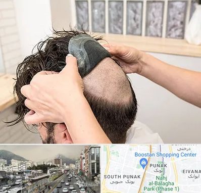 پروتز مو در پونک 