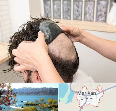 پروتز مو در مریوان