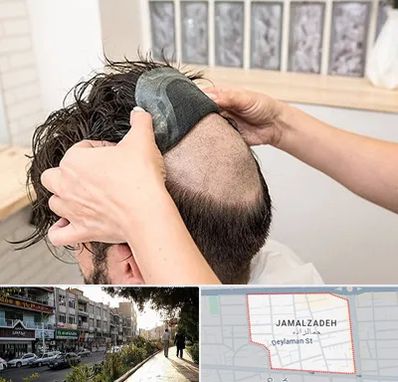 پروتز مو در خیابان جمالزاده