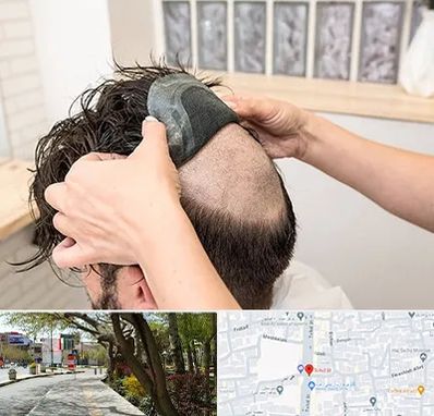 پروتز مو در خیابان توحید اصفهان 