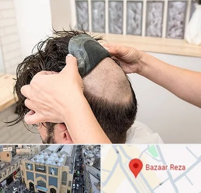 پروتز مو در بازار رضا مشهد