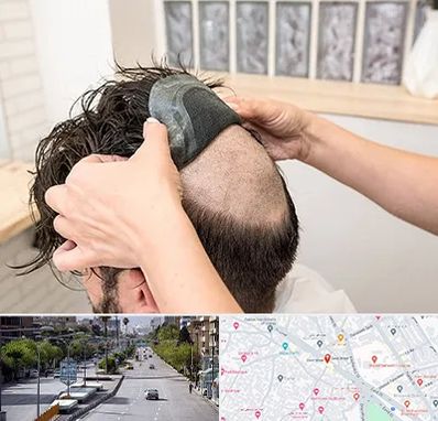 پروتز مو در خیابان زند شیراز 