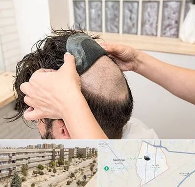 پروتز مو در واوان اسلامشهر