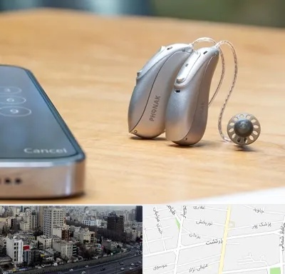 نمایندگی سمعک فوناک در زرتشت