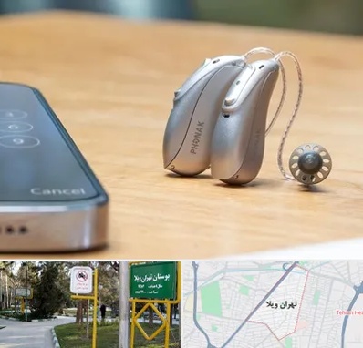 نمایندگی سمعک فوناک در تهران ویلا