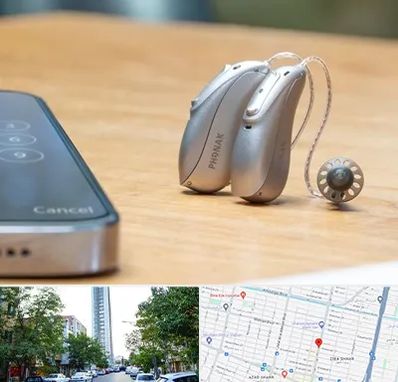 نمایندگی سمعک فوناک در امامت مشهد 