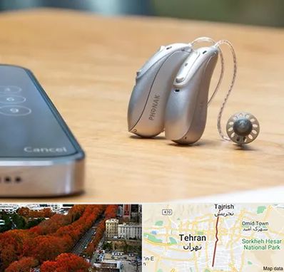 نمایندگی سمعک فوناک در ولیعصر 