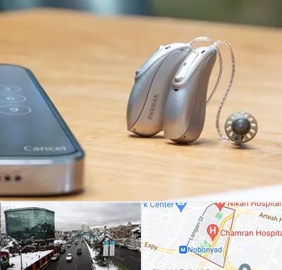 نمایندگی سمعک فوناک در اقدسیه 