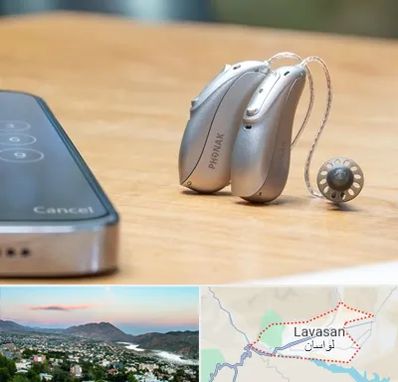 نمایندگی سمعک فوناک در لواسان