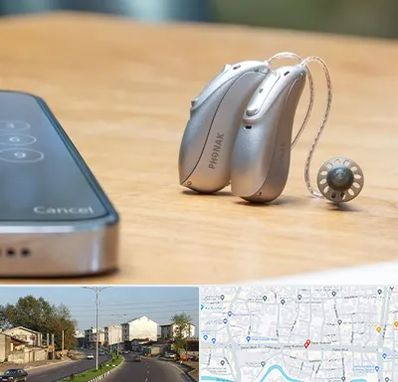 نمایندگی سمعک فوناک در ضیابری رشت 