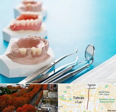 متخصص روکش دندان در ولیعصر 
