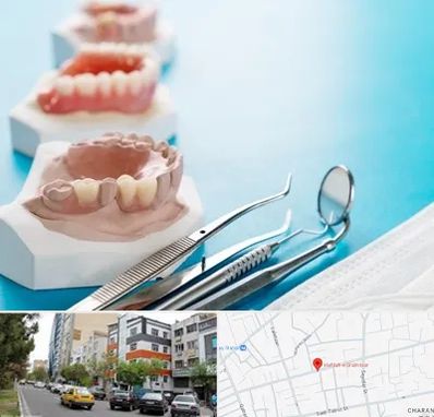 متخصص روکش دندان در هفده شهریور تبریز