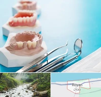 متخصص روکش دندان در رویان
