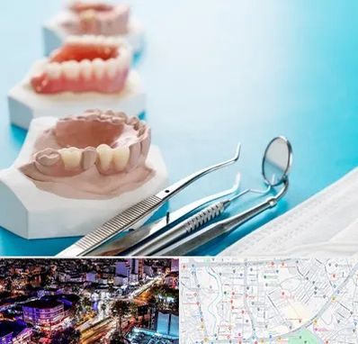 متخصص روکش دندان در منظریه رشت 