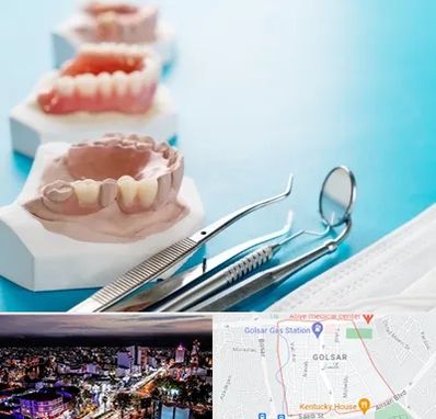 متخصص روکش دندان در گلسار رشت 