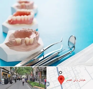 متخصص روکش دندان در ولیعصر شهریار