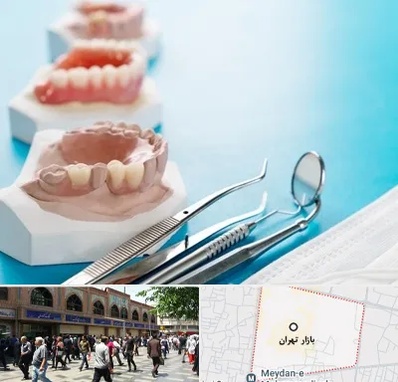 متخصص روکش دندان در بازار تهران