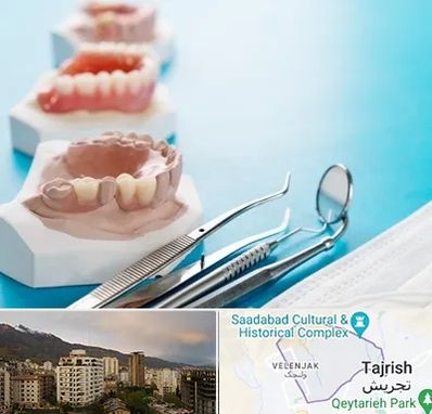 متخصص روکش دندان در زعفرانیه 