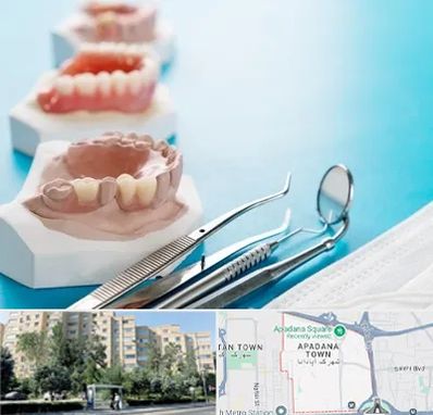 متخصص روکش دندان در آپادانا