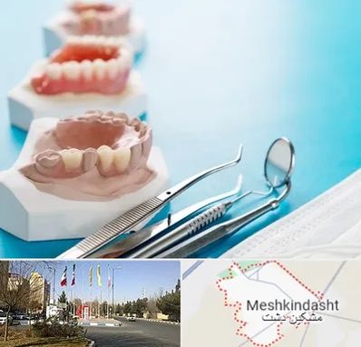 متخصص روکش دندان در مشکین دشت