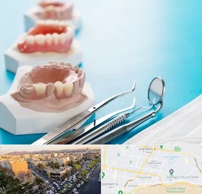 متخصص روکش دندان در تهرانپارس 