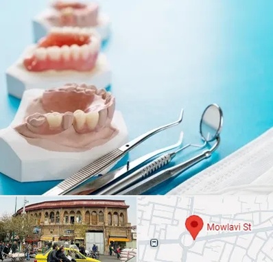متخصص روکش دندان در مولوی