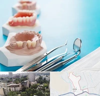 متخصص روکش دندان در اوین