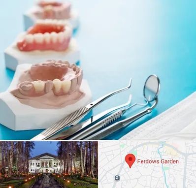 متخصص روکش دندان در باغ فردوس