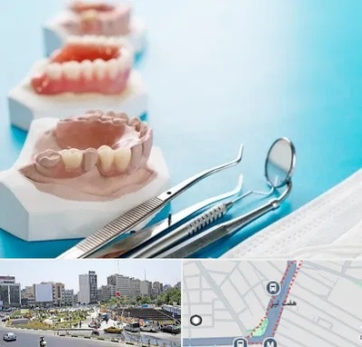 متخصص روکش دندان در هفت تیر