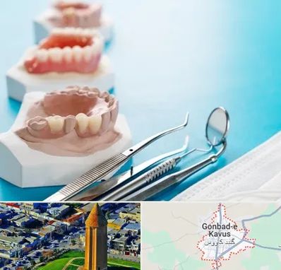 متخصص روکش دندان در گنبد کاووس