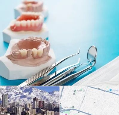 متخصص روکش دندان در ازگل