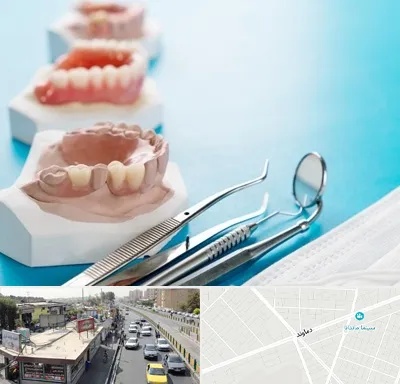 متخصص روکش دندان در خیابان دماوند